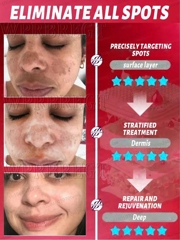 Handheld Home Facial Care Device At-Home Beauty Treatment for Spot Removal Blemish Eliminator Youthful Complexion Promoter
