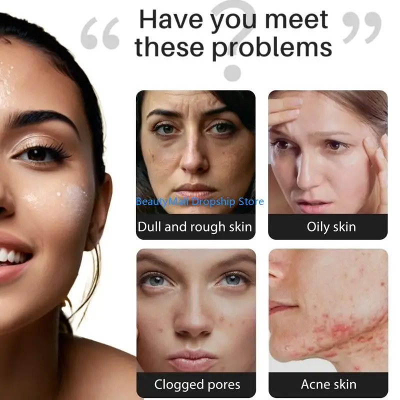 40JD 70 جرام صابون نياسيناميدات صابون عملي مرطب صابون سهل الاستخدام صابون تنظيف عميق للسفر المنزلي