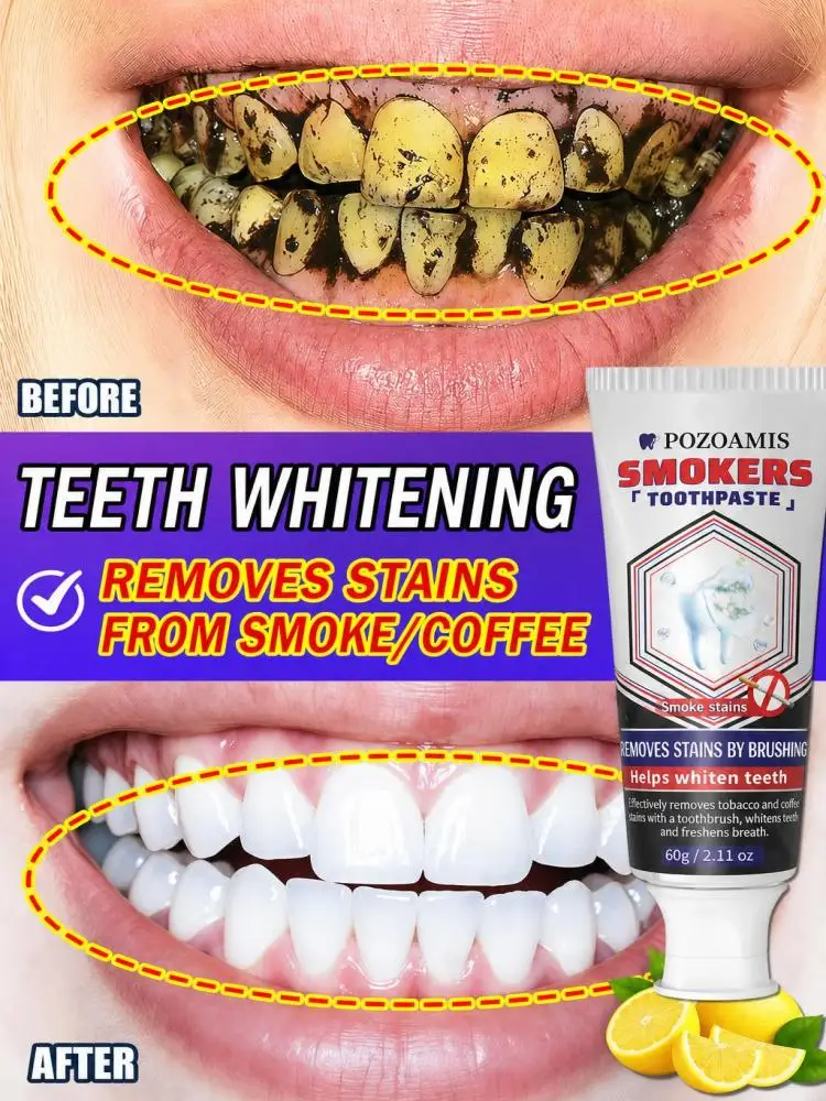 Smoker's Teeth Cleaning Toothpaste, Effectively Lift Surface Stains from Teeth, Brighten Smiling Appearance, Mint Fresh Breath Daily Oral Care