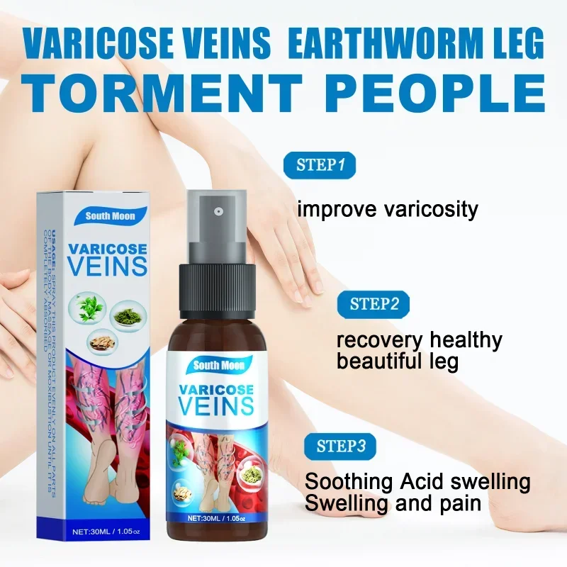 Spray for varicose veins Effective varicose vein relief cream to relieve Leg vasculitis phlebitis spider pain swelling treatment