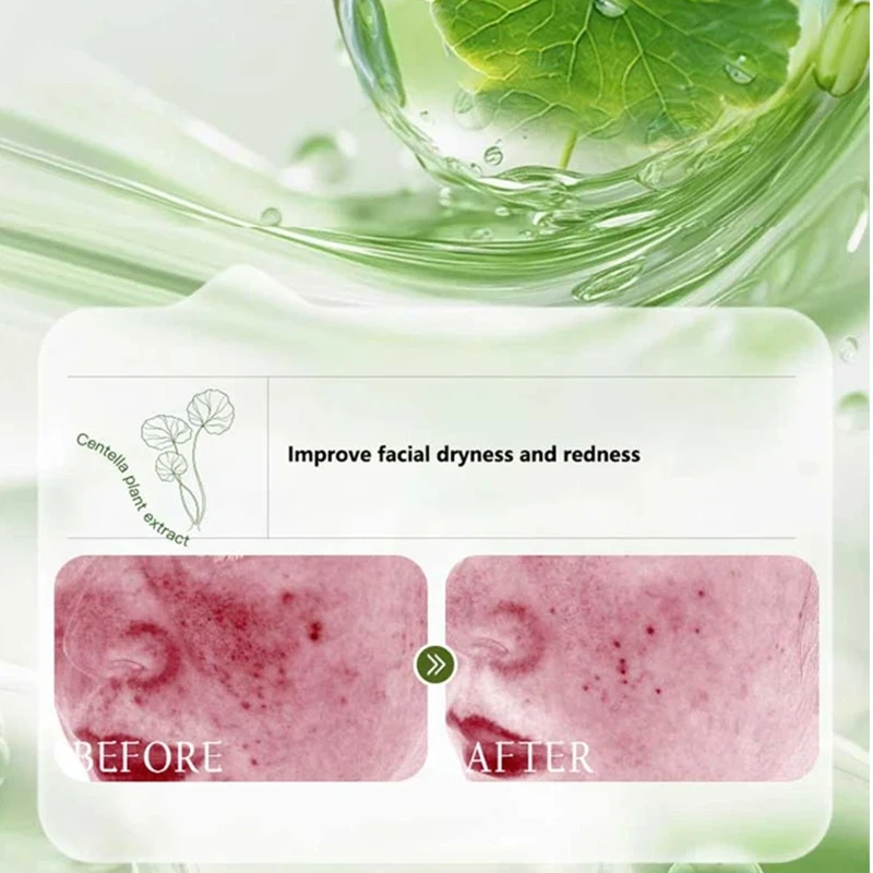 لوشن كينتيللا اسياتيكا مستخلص نباتي مستحلب مرطب منعش للتحكم في الزيت لوشن الأحماض الأمينية المهدئ 2026 #5