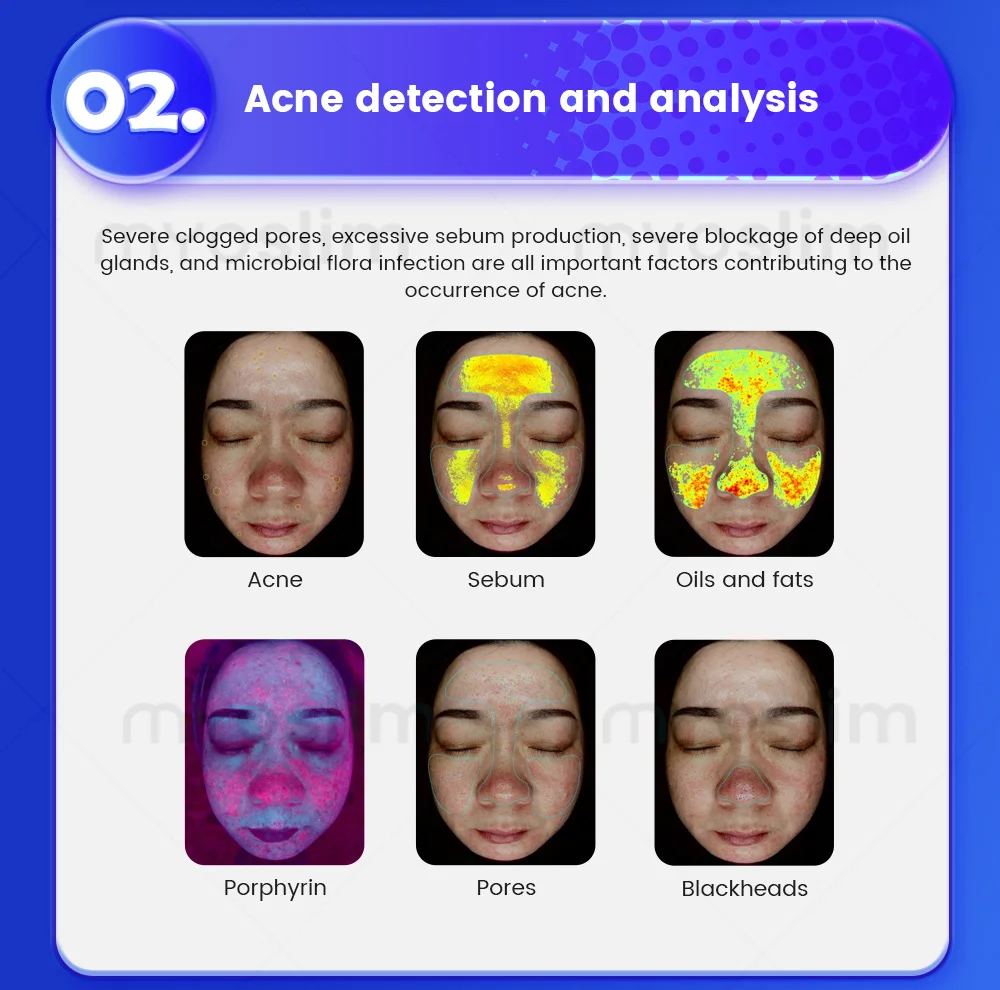 

Professional 3d Scanner Face Mirror Device Dermatoscope Skin Face Diagnostics Analysis Machine Facial Skin Analyzer Machine