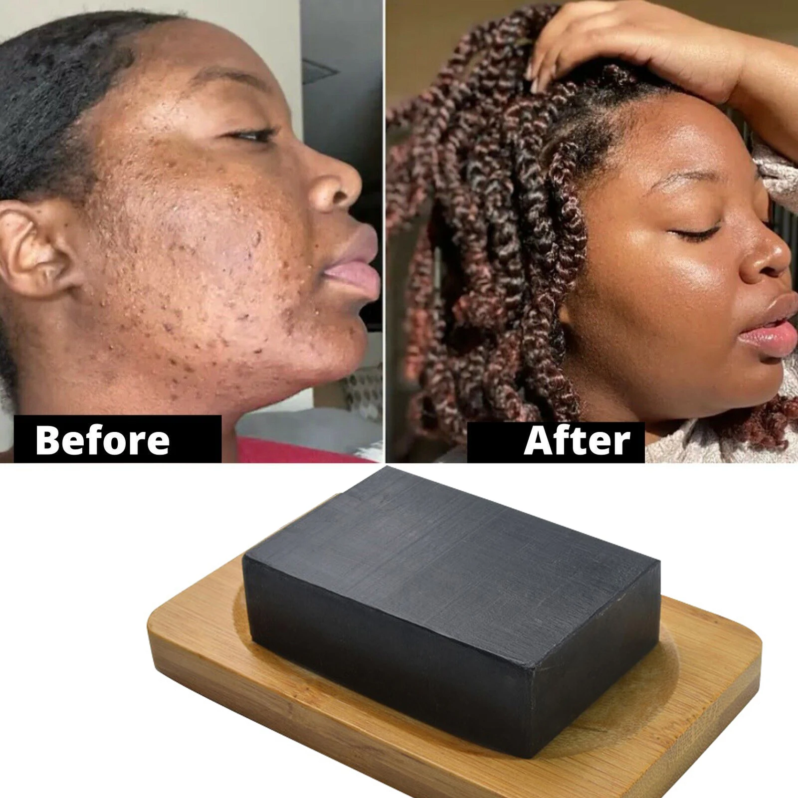 Sabonete Preto Africano Original, Removedor De Manchas Escuras, Removedor De Acne, Pele Clara 100g