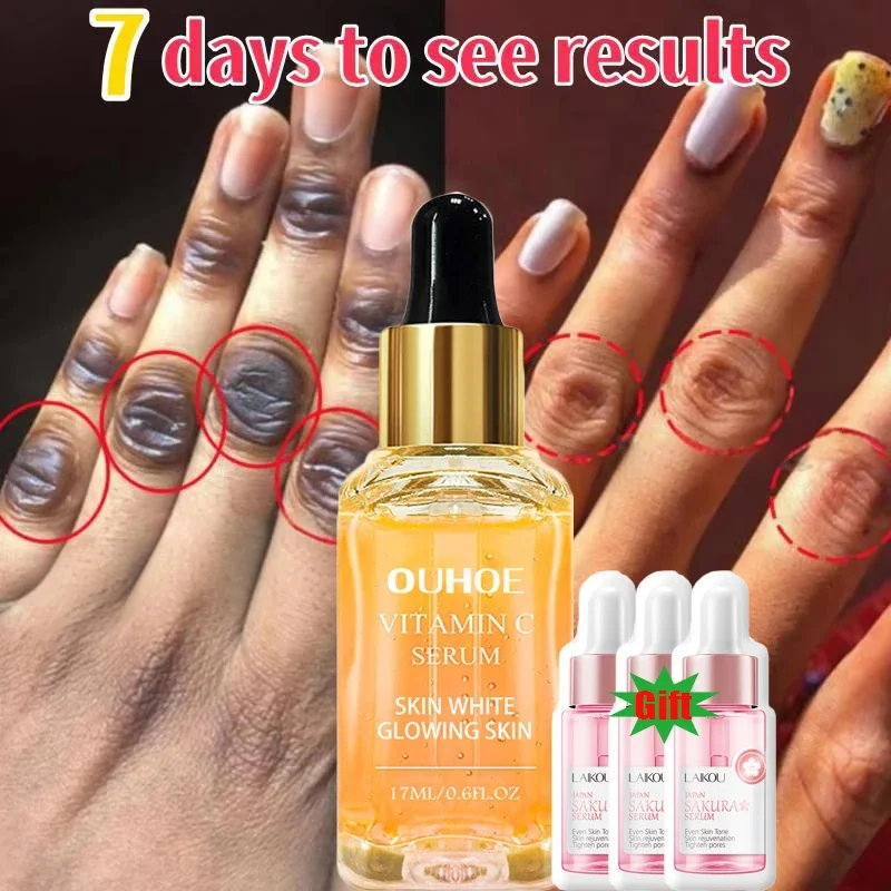 

Dark Knuckles Fast Brighten Serum Elbows Hand Knuckle Brightening Serum Knee Black Skin Quickly Lighten Stains Remover Essence