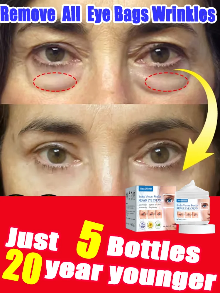 

Мгновенно удаляет мешки под глазами, снижает тонкие морщины, улучшает эластичность кожи, устраняет темные круги, осветляет глаза.