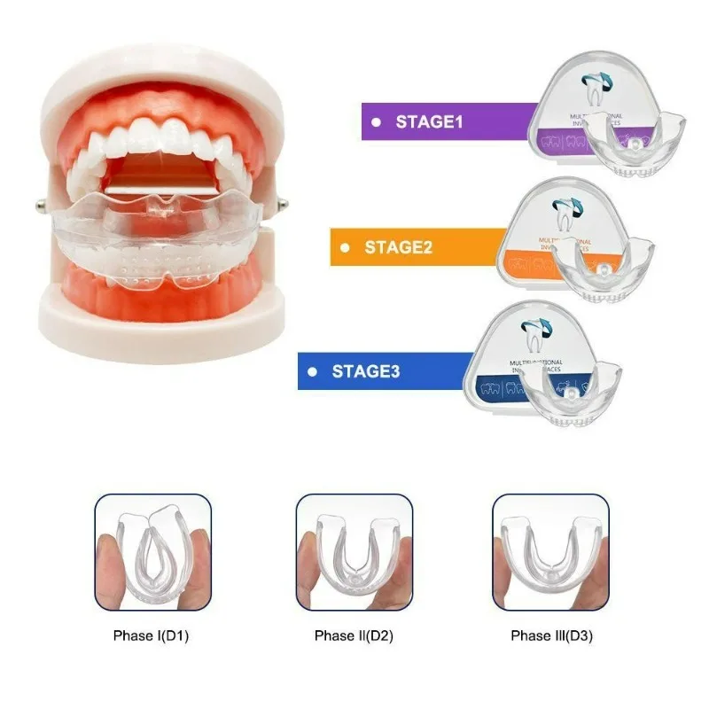 Dental Braces Teeth Trainer Alignment Mouthpiece Tooth Orthodontic Brace Straightener for Adults 3 Stages Dental Accessories