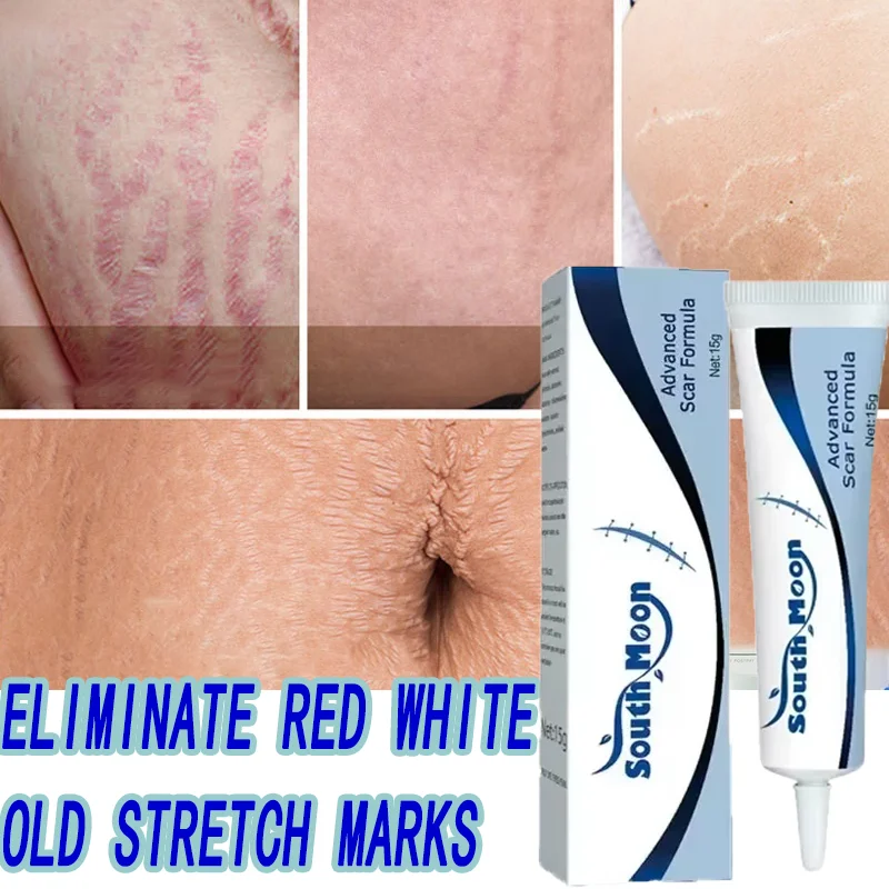 

Stretch Mark remove Cream Increase Elasticity Pregnant Women Anti-Aging Anti-Winkle Cream Smooth Firm Erases all stretch marks