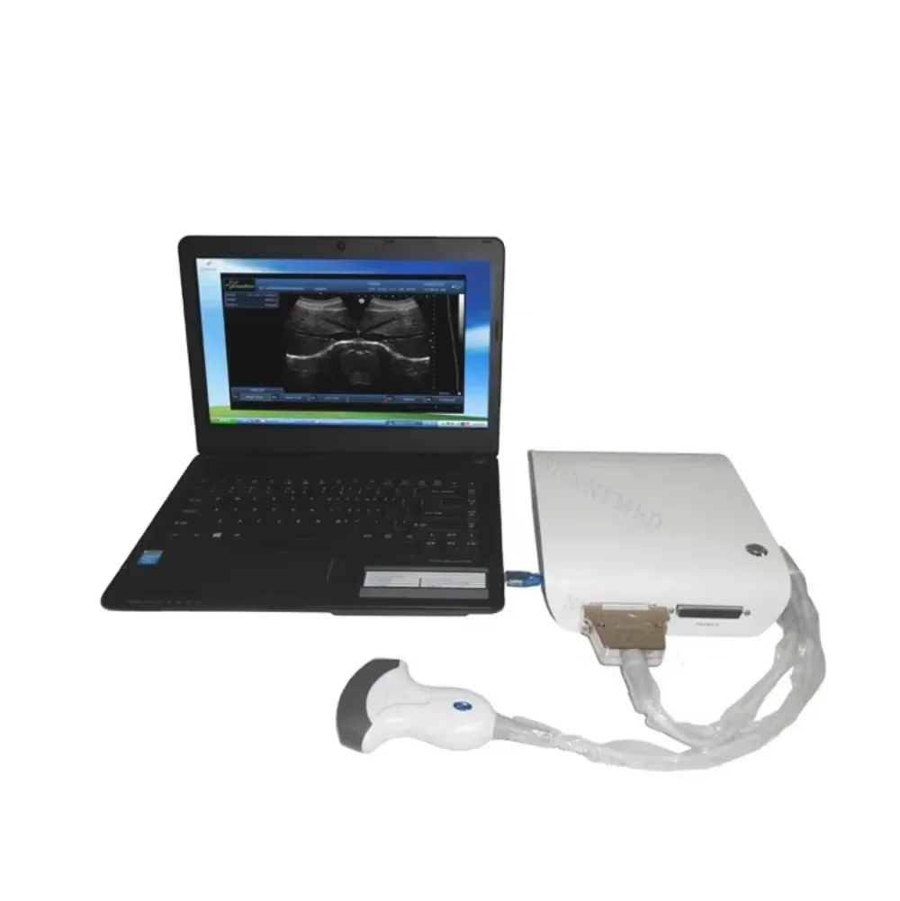 

SY-A010 5 Segment Frequencies Black and White Scanner Portable 3D Ultrasound B Scanner
