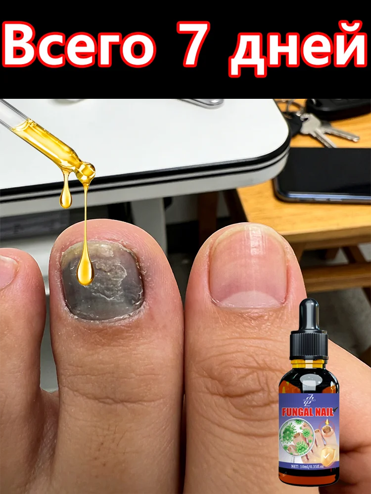 

Toenail Repair Essence Fungal Nail Care Serum For Thick Yellow Nails Onychomycosis Paronychia Care Nourishing Brightening Nails