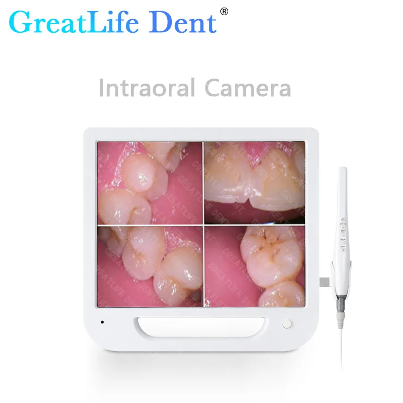 GreatLife Dent 17 inch LCD Monitor Dental Intraoral Camera VGA Intra Oral Camera Oral Observation Instrument with Bracket Holder