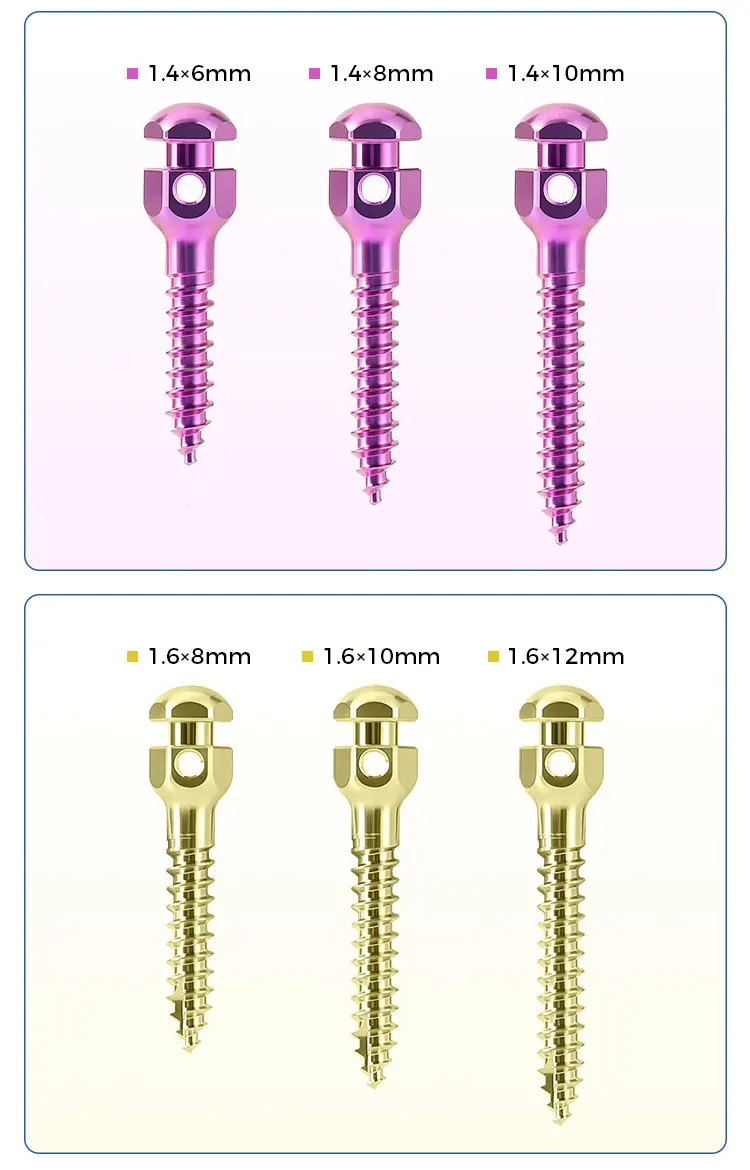 AZDENT Dental Orthodontic Mini-Schraube Sterile Titanlegierung Selbstbohrende Gewindeschrauben Implantat-Mikroschrauben Zahnmedizin – Detail 7
