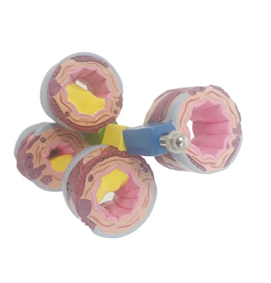 

High-quality hot-selling bronchial anatomy models