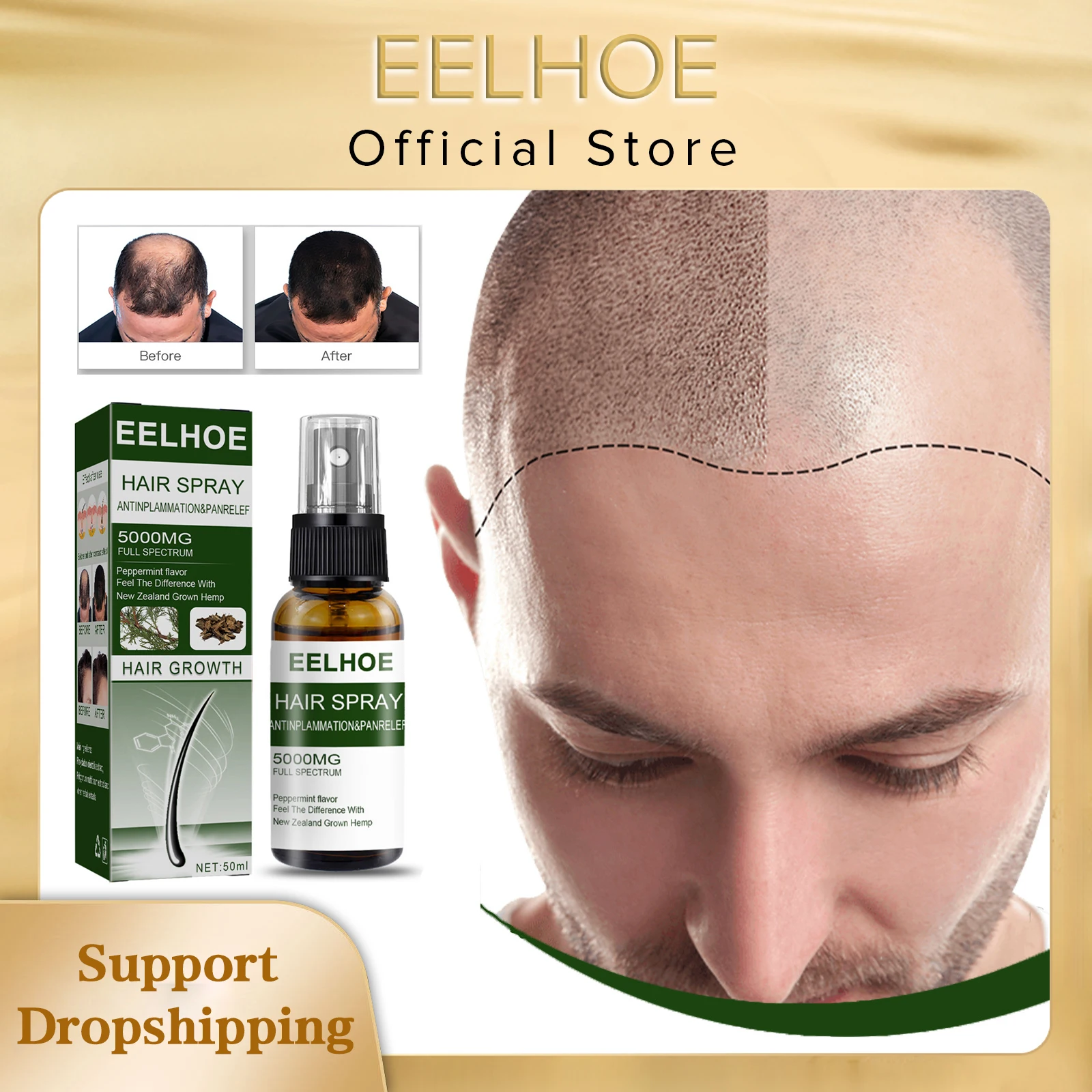 EELHOE Hair Growth Spray for Anti Hair Loss Fast Treatment Scalp Prevent Hair Thinning Dry Frizzy Conditioning Strong Hair Root