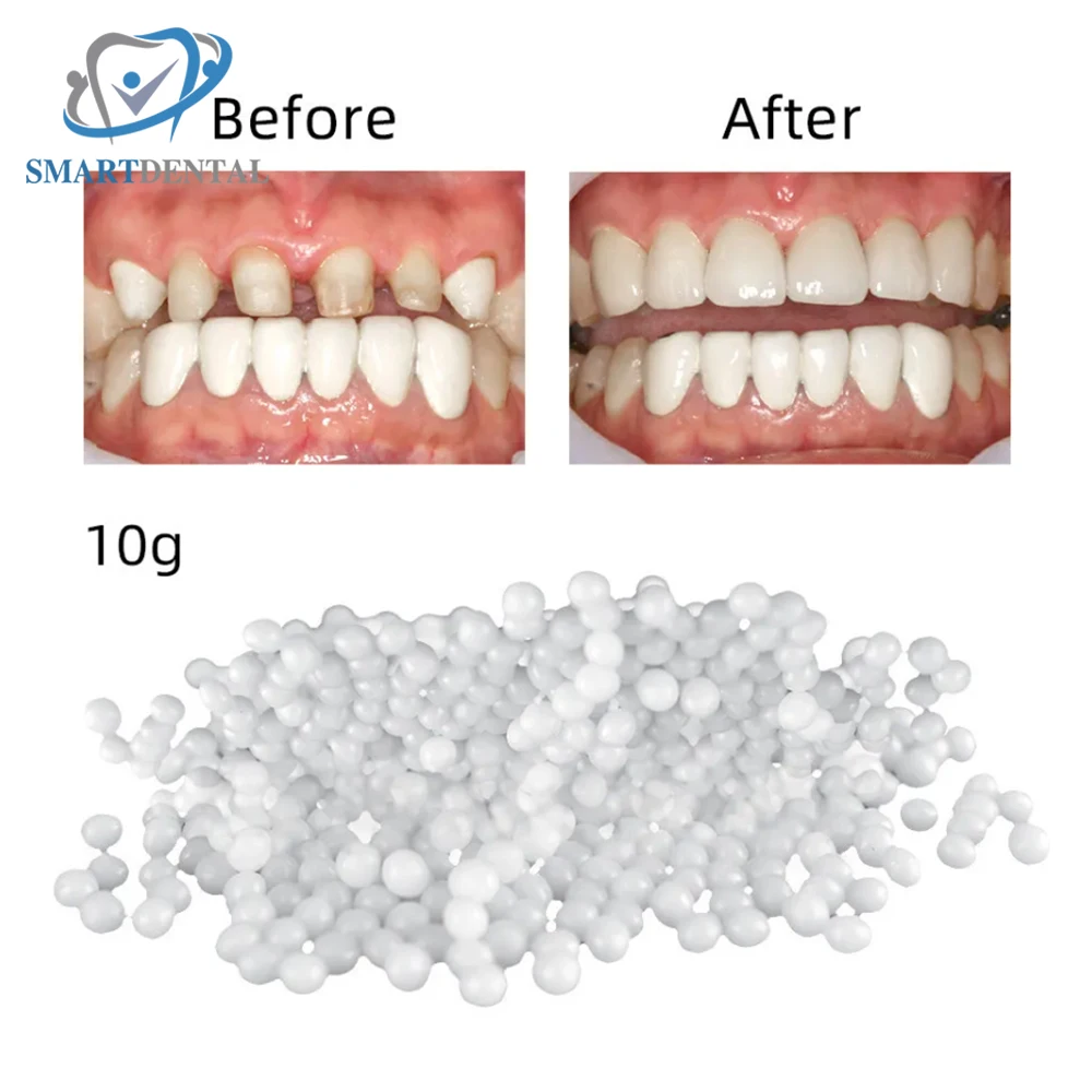 10g/Bag Tooth Repair Kit-Thermal Beads for Filling Fix The Missing and Broken Tooth or Adhesive The Denture Fake Teeth