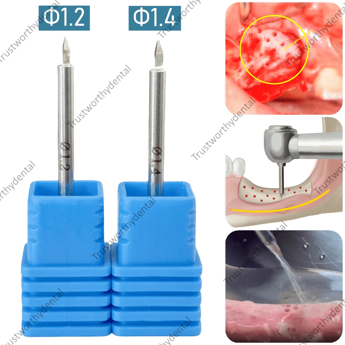 Dental Nutrient Drill Bone GBR Drill Increment Implant Nutrient Hole Drill Promote New Bone Generation Formation Bone Drill