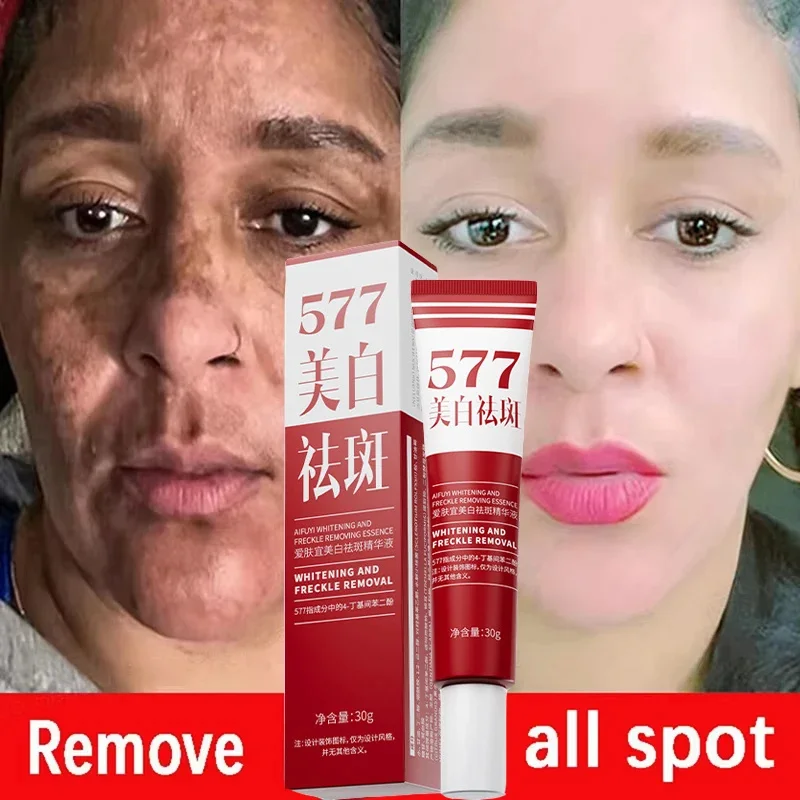 

577 Whitening Freckles Face Cream Removal Melasma Dark Spot Corrector Lighten Melanin Pigmentation Brighten Anti-Aging Skin Care