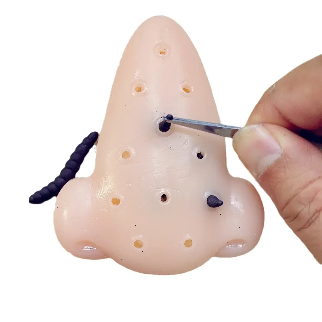 1PCS Pimple Popping Blackheads Remover Toy Funny Acne Squeezing Trick Game Anxiety Relief Decompression Toys