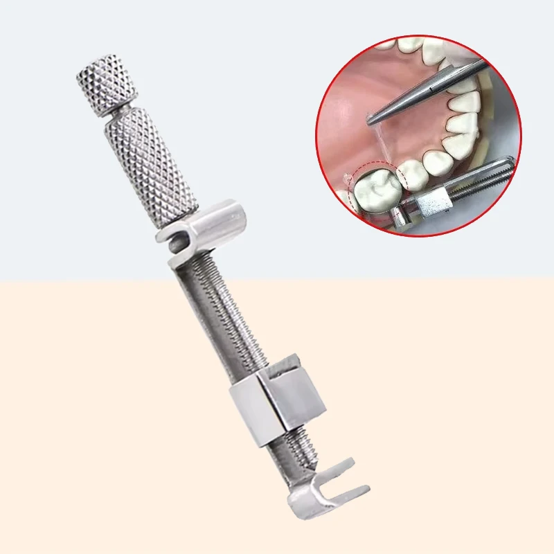 

Stainless Steel Tofflemire Retainer Matrix Holder 1PC Dental Instrument for Restorative Dentistry Dentist Lab Tool