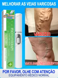 Laser Equipment for Varicose Veins, Clear varicose veins and Relieve Legs