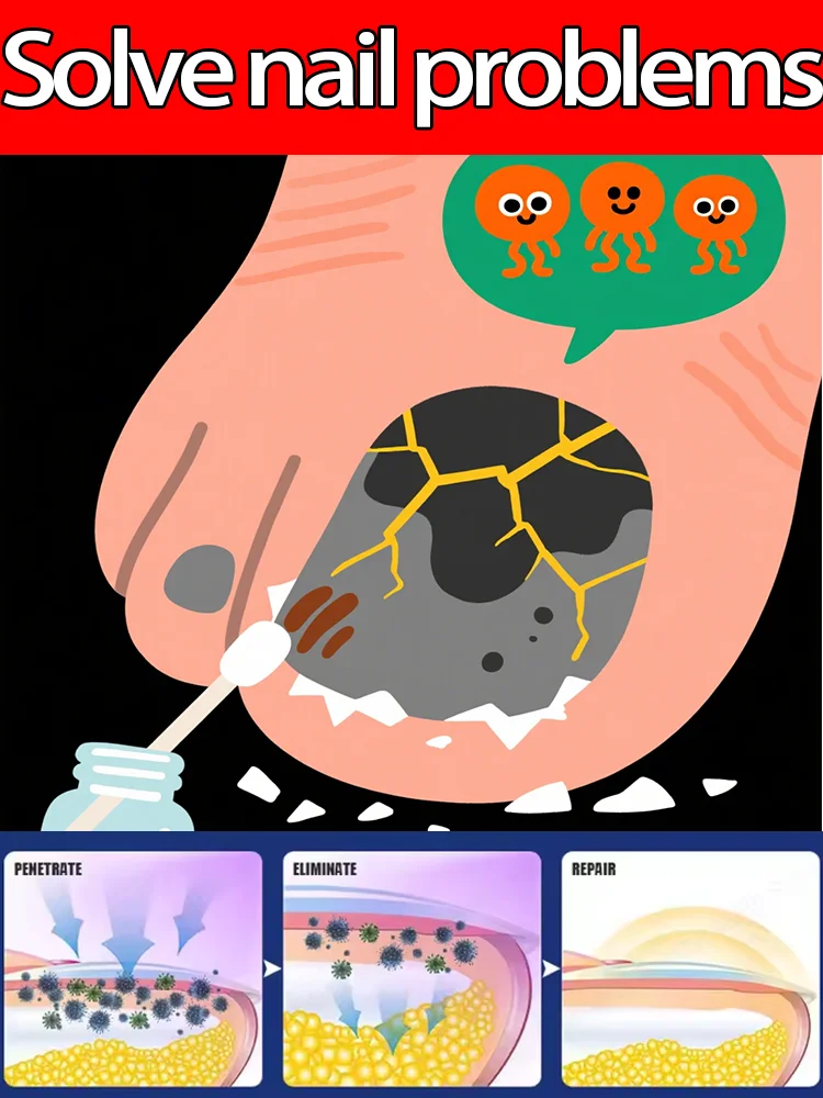 

ᵈᵉᶜᵏ on "Aurora Healing": Using plant energy to dissolve fungal shadows