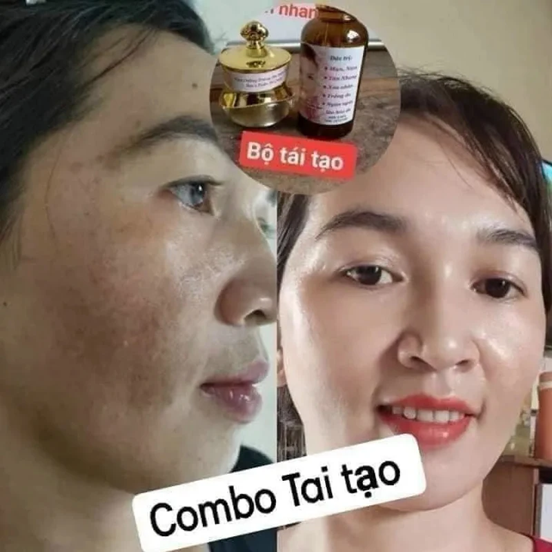 Combo TÁI TẠO ThẢO … - image