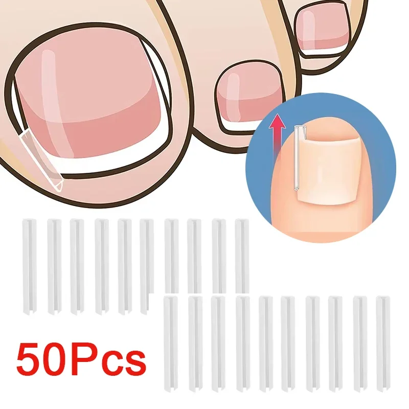 50 قطعة التصحيح المرن ملصق باديكير أداة نام أظافر تصحيح أداة نام تو مسمار العلاج استقامة كليب هدفين