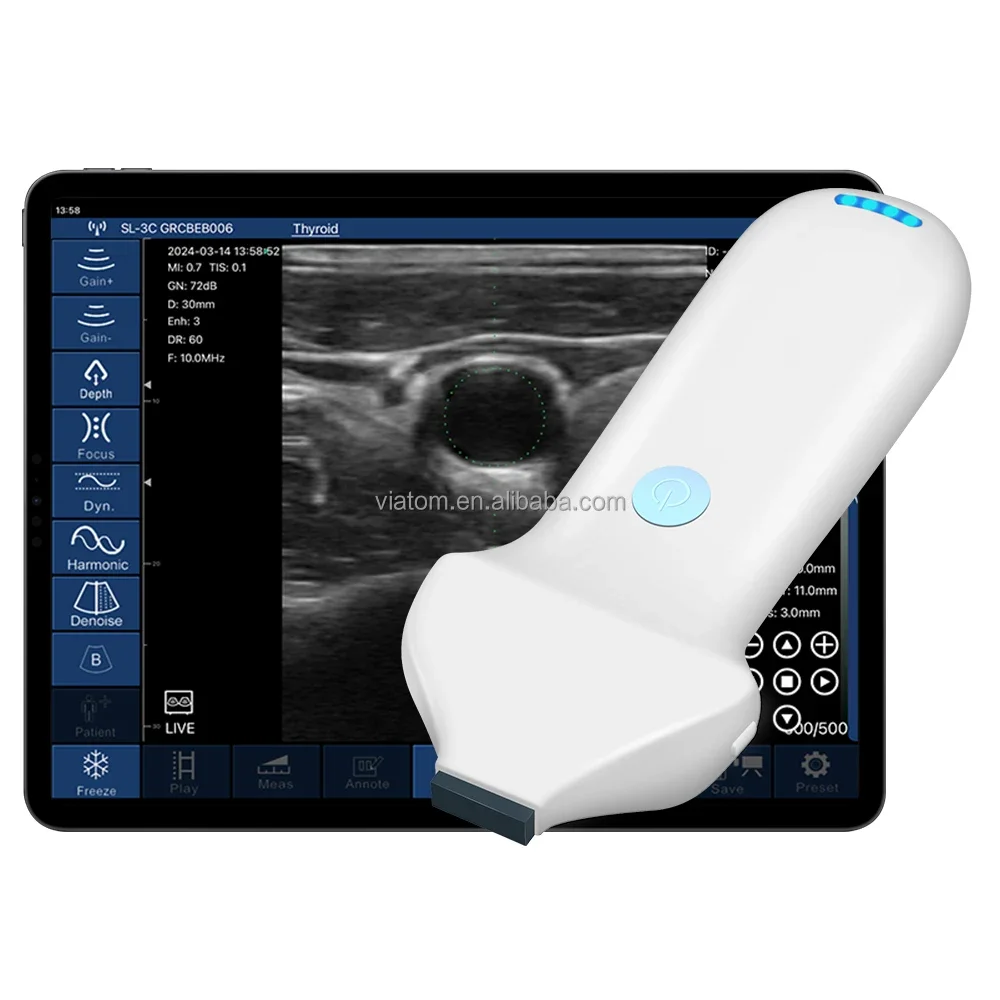 Viatom 192 Elements Handheld Ultrasound Beauty Injections High Frequency Linear Portable 18/24Mhz Wireless Ultrasound Probes