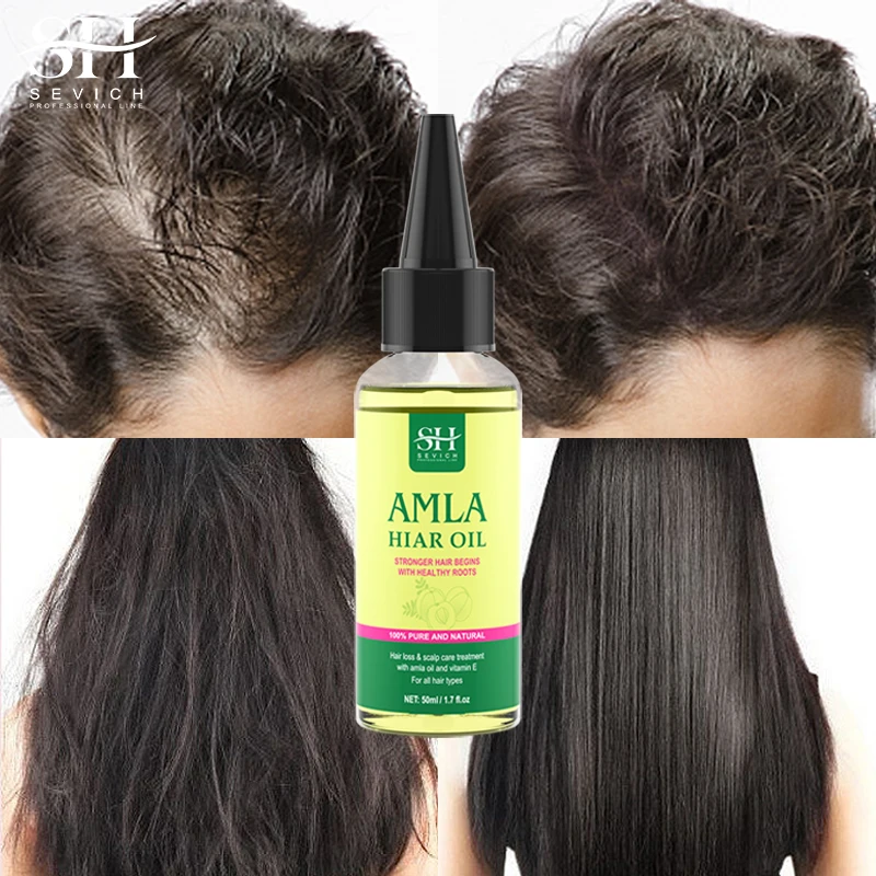 Original Amla Oil For Hair Growth India Gooseberry Hair Oil Anti Hair Loss Scalp Treatment Ayurvedic hair growth oil Sevich