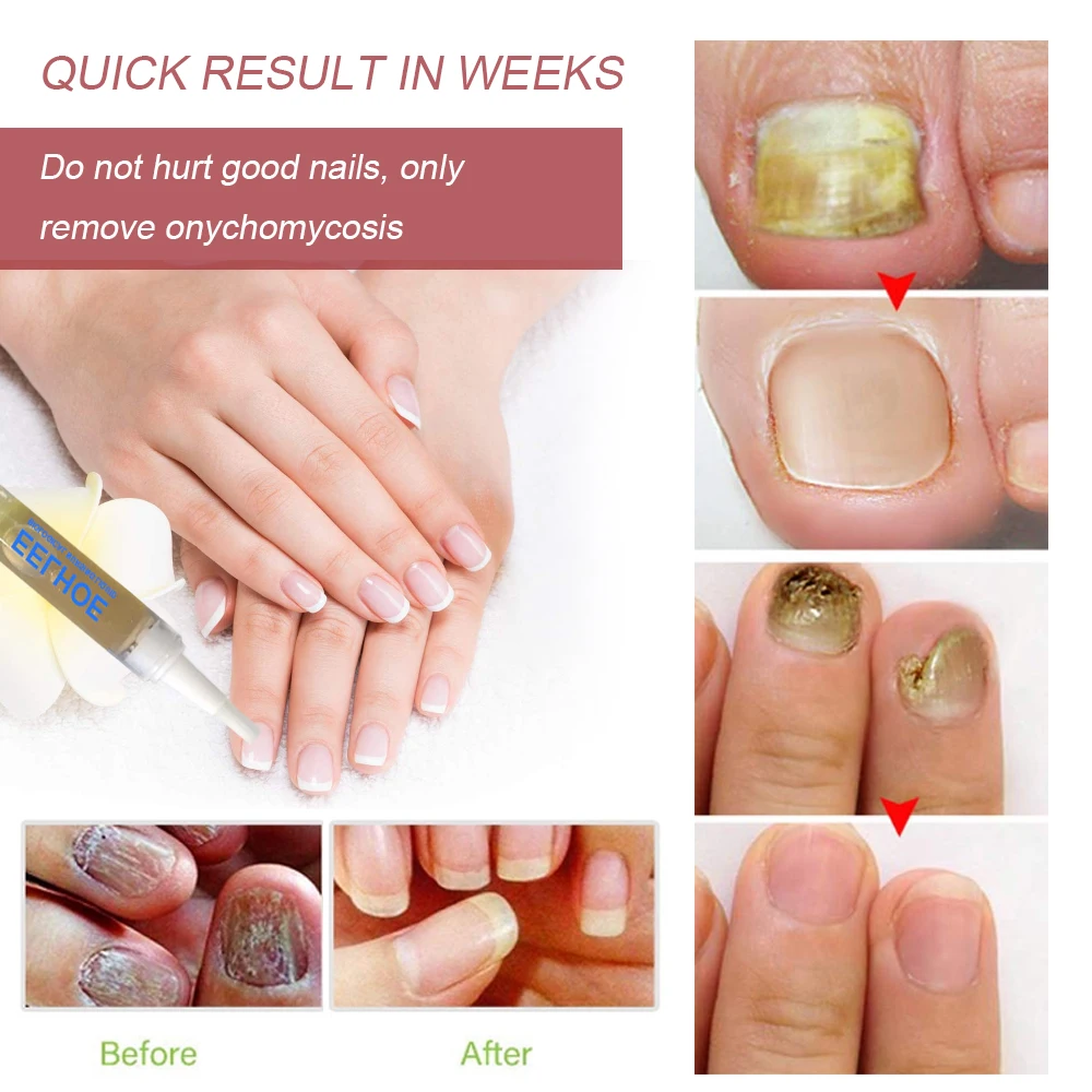 Nail Care Treatment, Hand & Foot Cleanser, Gentle Cuticle Softener, Daily Nourishing Glossy Nail Serum, Manicure Strengthener view 3