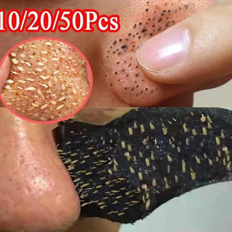5/50 Uds eliminador de espinillas pegatina para la nariz máscara para el tratamiento del acné pegatina para la nariz de puntos negros limpiador de poros de la nariz limpieza profunda cuidado de la piel