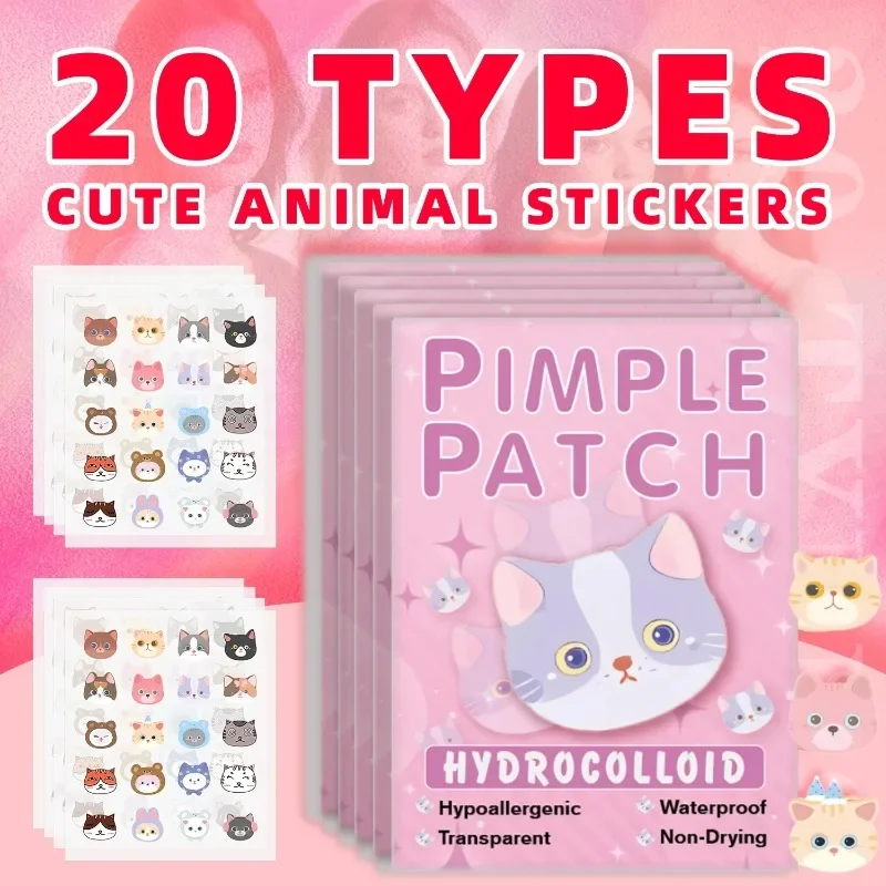 2pieces of cartoon cat acne patches, facial acne patches, concealer acne patches, and pimples patches. Ultra-thin and breathab