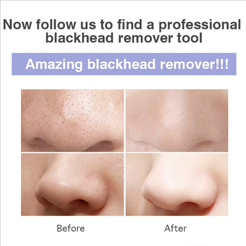 Electric Pore Blackhead Removal Vacuum Cleanser Acne Removal Blackhead Remover Facial Pore Cleaner Machine Beauty Skin Care