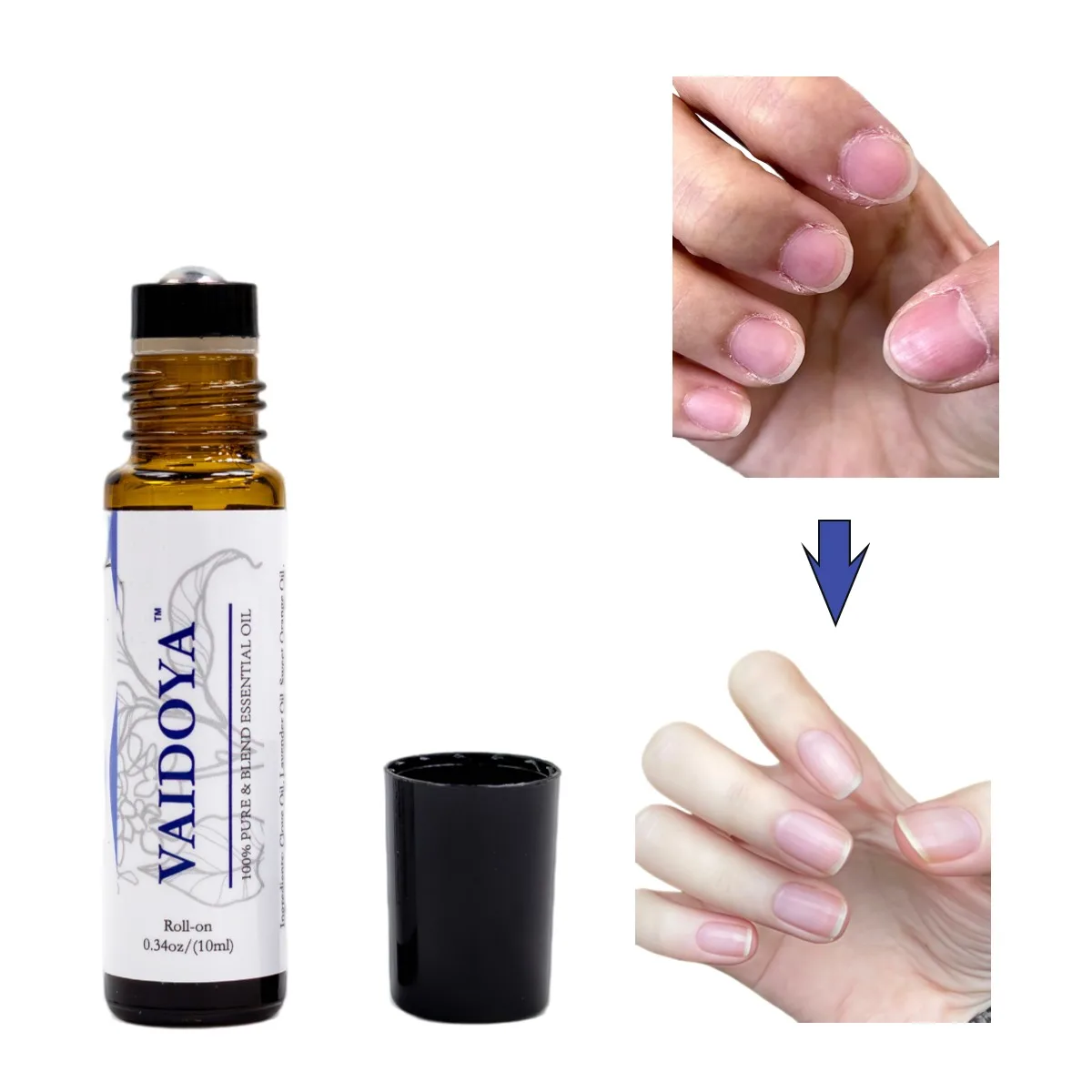 

Tuhopeta1PC Natural Plant-Based Nail Armor Oil Fungus Repair Thickening Yellowing Anti-Itch Treatment for Damaged Toenails