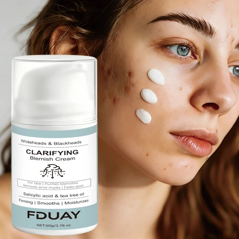 FDUAY Salicylic Acid  Tea Tree Oil Acne Clearing Repair Cream - Fades Acne Marks Smoothes Skin for Clearer Complexion50g