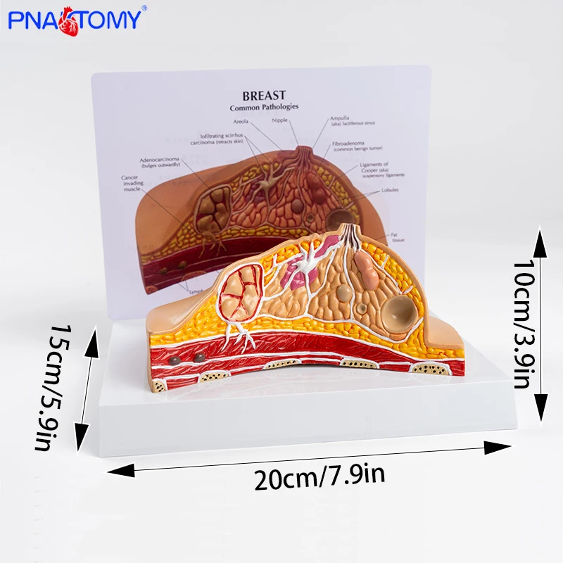 Breast Anatomy Model Teaching Aids Female Breast Structure Medical Beauty Salon Props Pathology Breast Dissection Teaching Gift