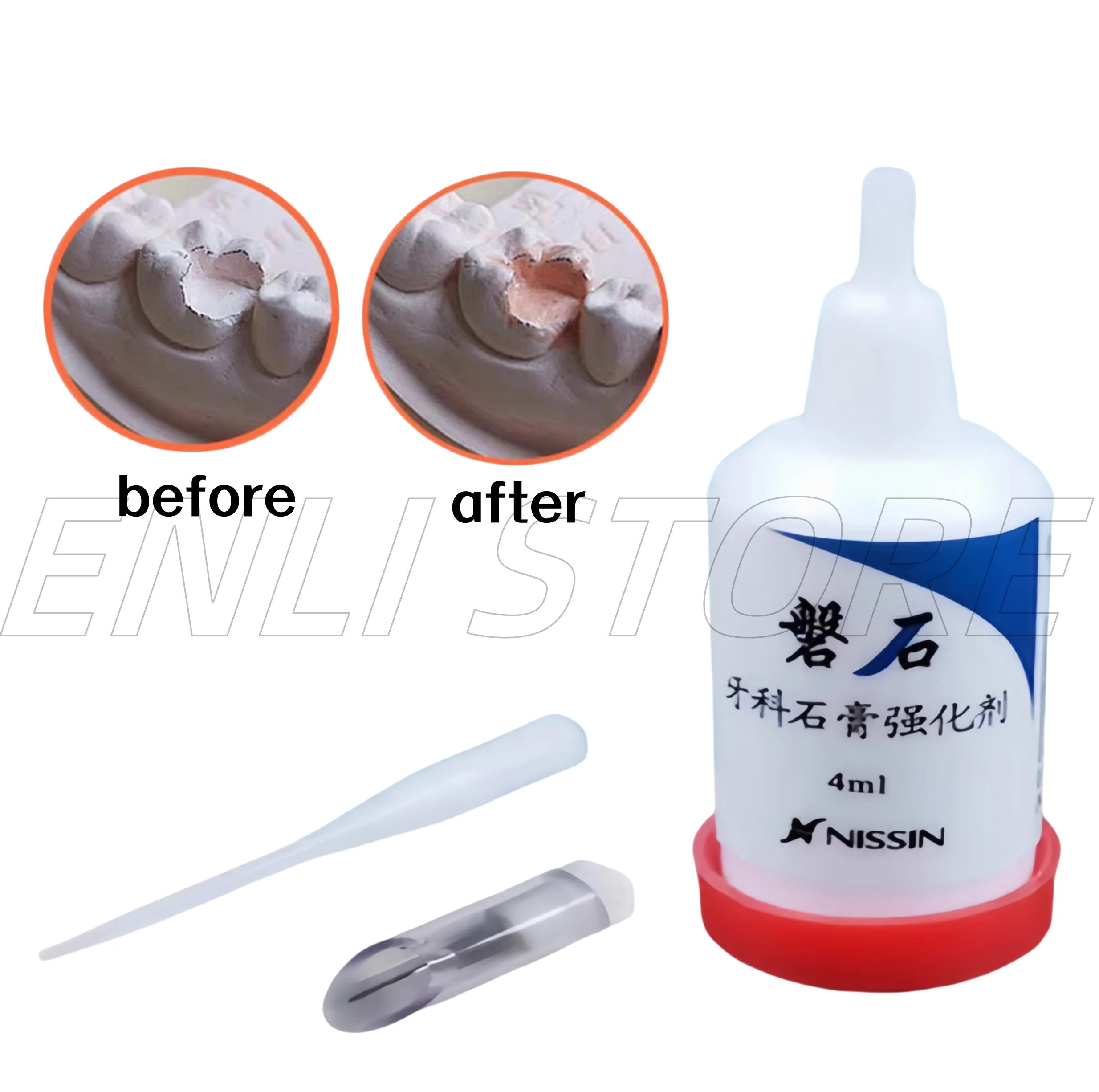 

Утвердитель стоматологического камня — для укрепления гипсовых моделей, защита кромок базового зуба и быстрое разделение моделей Стоматологическая лаборатория