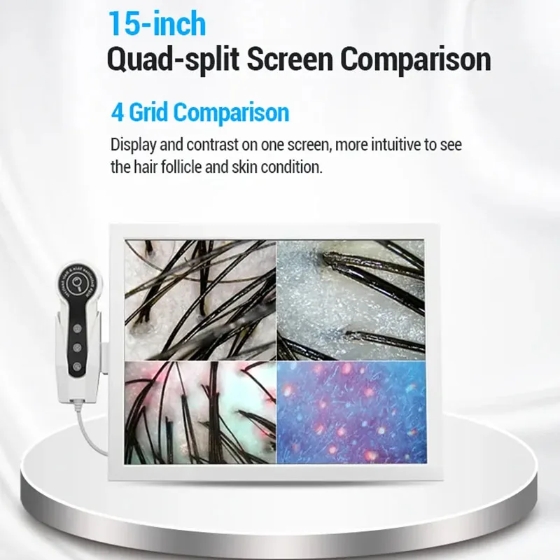 Commercial Hair Analyzer HD Digital Trichoscope Hair Follicle Scalp Detection Machine for Hair Spa Clinic