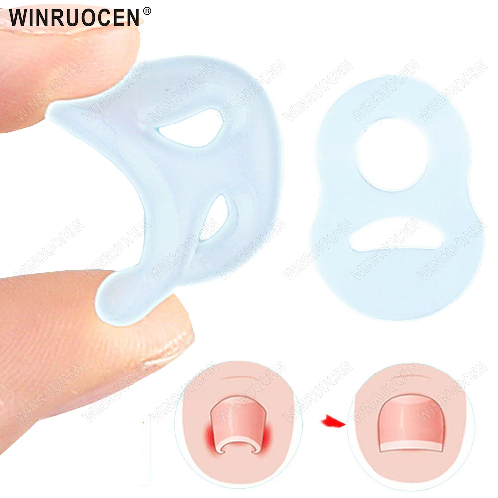 Silicone Ingrown Toenail Correction Tool Invisible Toe Nail Straightening Protector Brace Pedicure Feet Care Accessory