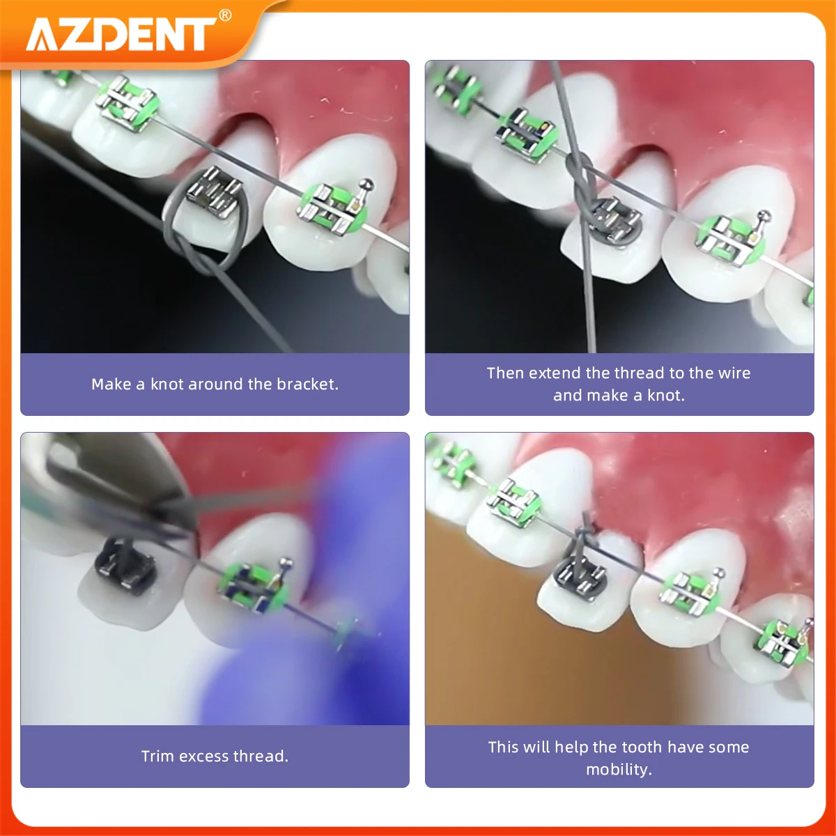 AZDENT-Fil artificiel astique Dentaire Orthodontique, 25 Pieds/Rouleau, Solide, Traction LigmoPower, Tube Ortho Fils, Taille 0.020/0.025/0.030