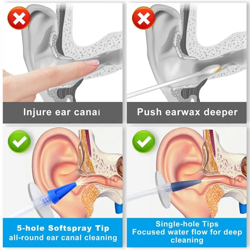Beauty For Safe, Efficient Ear Cleaning With Ear Wax Removal Kit Featuring Multi-Nozzle Design
