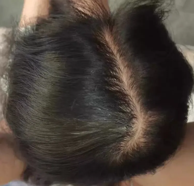 Customer review photo