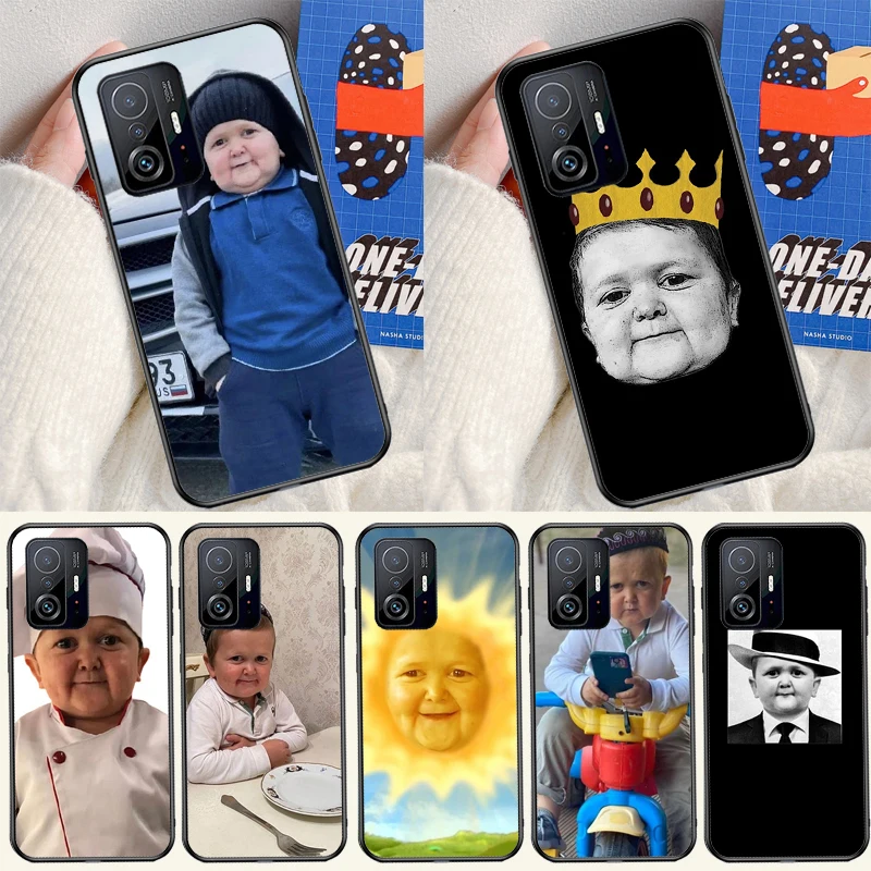 Funny Hasbulla Case…