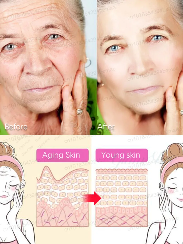 Say goodbye to wrinkles