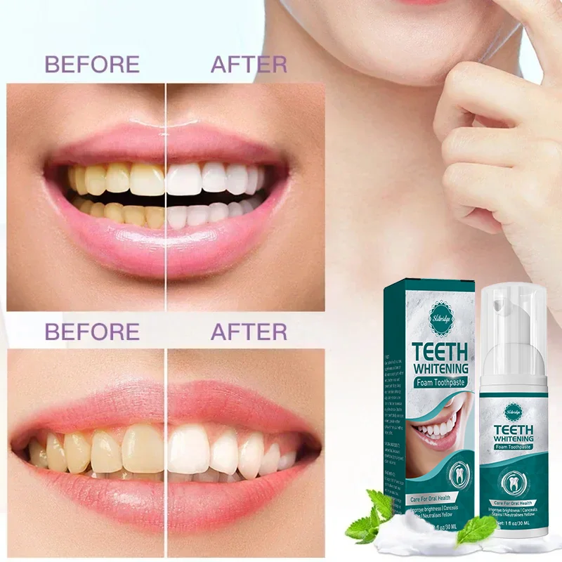 

Teeth Whitening Toothpaste Tooth Whiten Tartar Removal Mousse