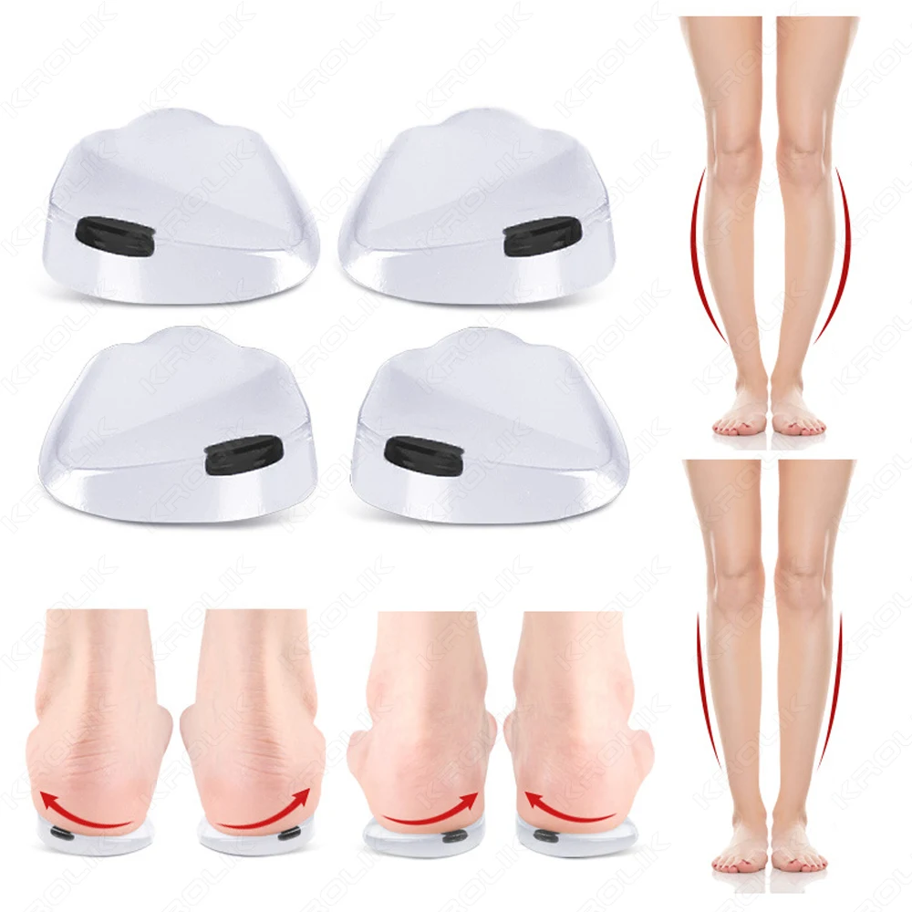 2/1Pair Orthopedic Insoles for Feet O/X Leg Type Valgus Correction Men Women Silicone Gel Shoes Insole Magnet Massage Shoe Pads