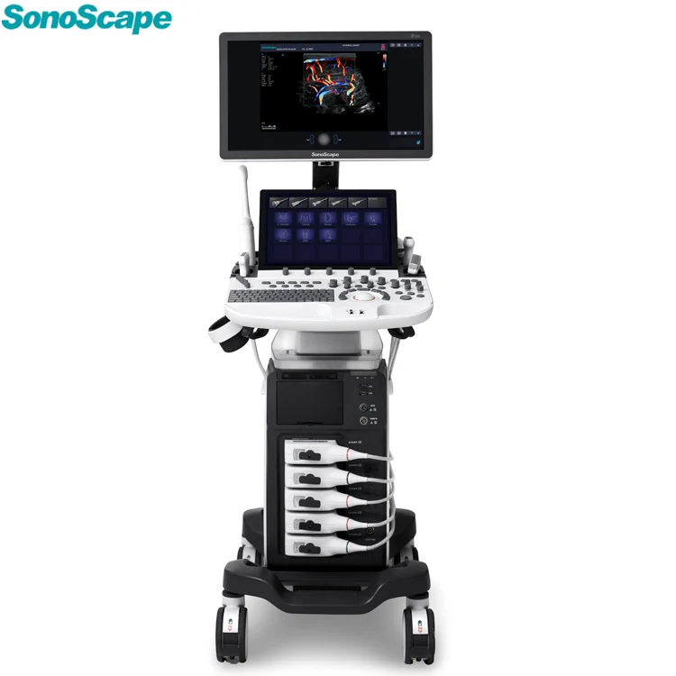 Prodotti soggetti a negozionationadvanced Touch Screen Sonoscape P40 Digital Color Doppler Ultrasound Machine