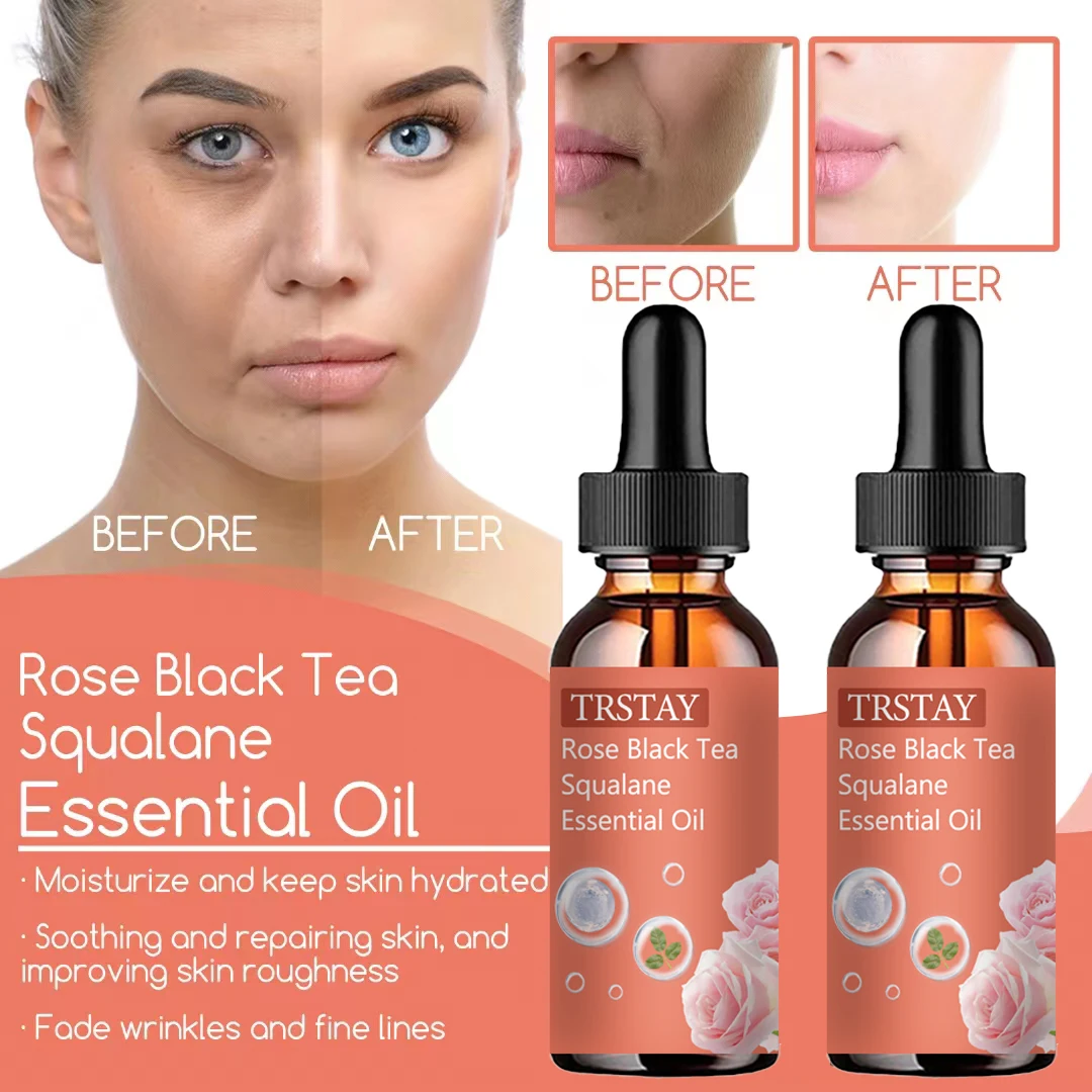 Rose black tea squalane essence can prevent dullness, dry, moisturize, whiten, resist wrinkles and tighten skin