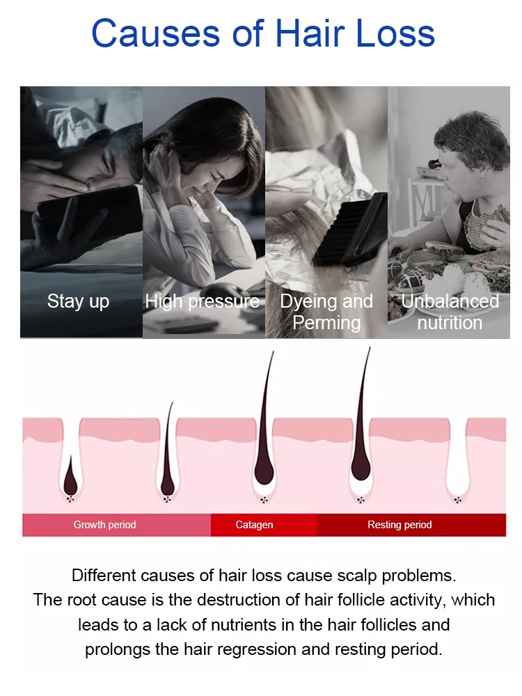 Haz el bosque del tiempo más exuberante, la pulverización diaria puede fortalecer las raíces y promover el nuevo crecimiento.