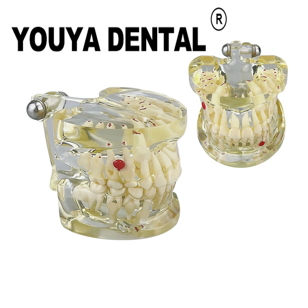 

Child Deciduous Teeth Pathology Tooth Model for Dentist Student Practice Training Studying Oral Medical Dentistry Tools