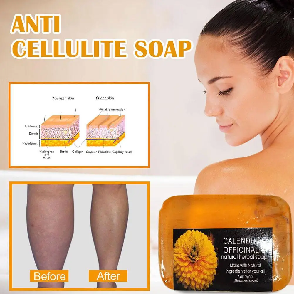 Anti Celulite Calêndula Orgânica Sabonete, Pele Firming, Anti-Inchaço, Perda De Peso, Emagrecimento Soro Natural, Massagem Spa Beleza, Quente